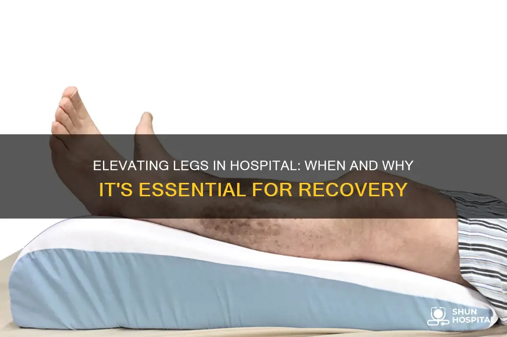 when do you elevate legs in hospital