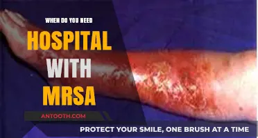 When to Seek Hospital Care for MRSA Infections: Key Signs