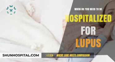Lupus Hospitalization: When Symptoms Demand Immediate Medical Attention