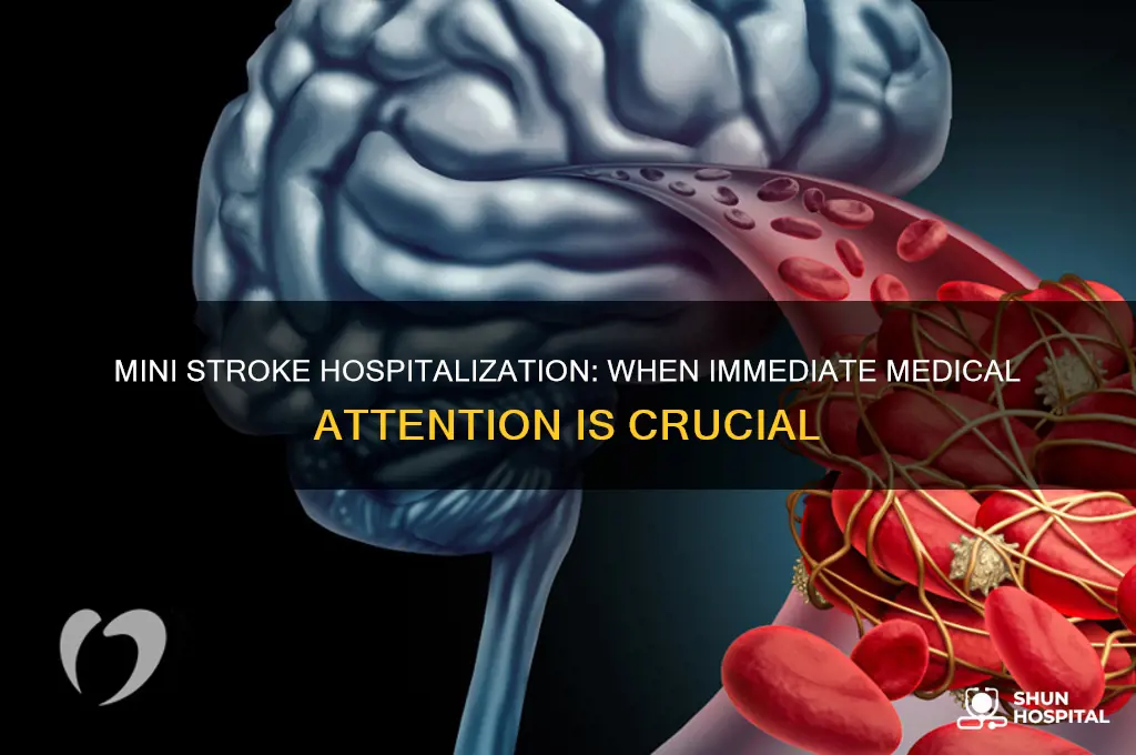 when does a mini sroke require hospitalization