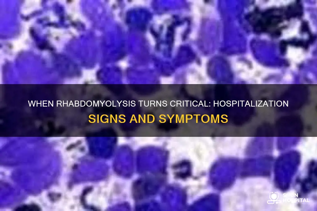 when does rhabdomyolysis require hospitalization