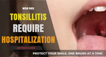 When Tonsillitis Turns Severe: Hospitalization Signs and Symptoms