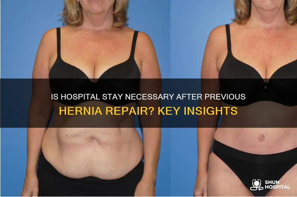 when having a previous hernia repair is hospital stay required