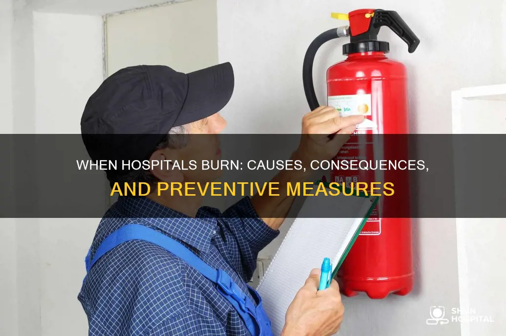 when hospital burn