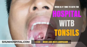 When Should You Go to the Hospital for Tonsil Issues?