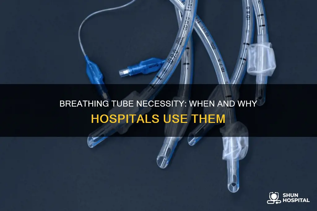 when might someone need a breathing tube in a hospital