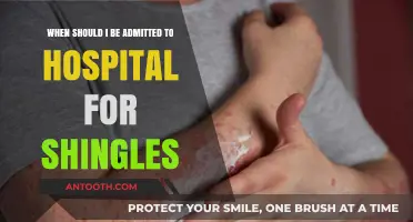 When to Seek Hospital Admission for Shingles Symptoms and Complications