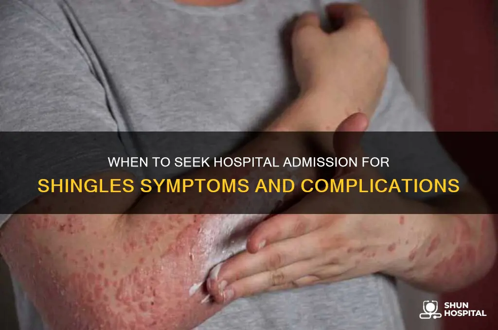when should i be admitted to hospital for shingles