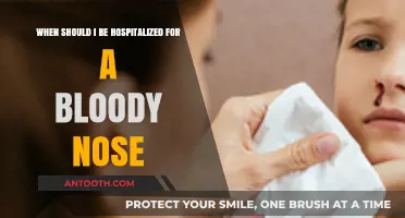 When to Seek Hospitalization for a Persistent Bloody Nose