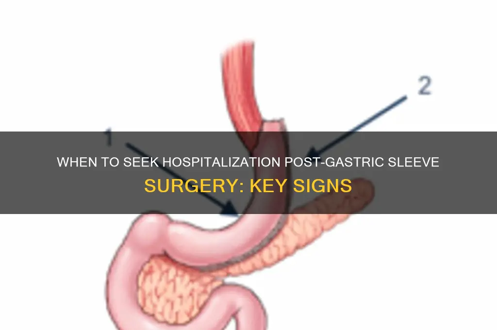 when should you be hospitalized after gastric sleeve surgery