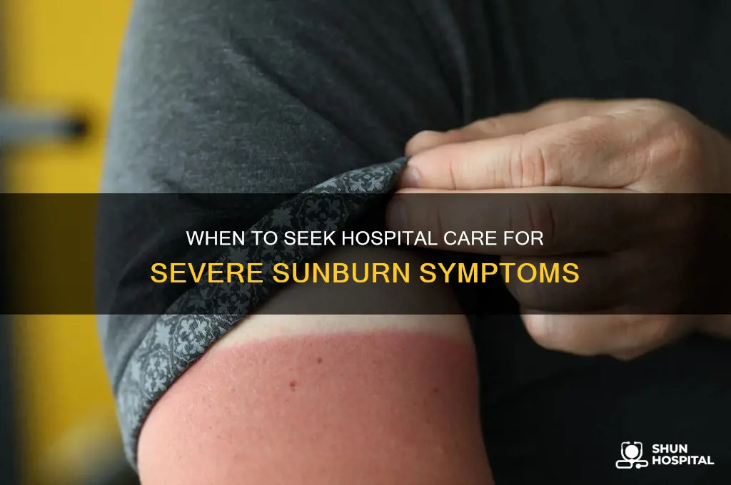 when should you gobto hospital for sunburn