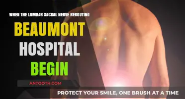 Beaumont Hospital's Lumbar Sacral Nerve Rerouting: Procedure Start Date