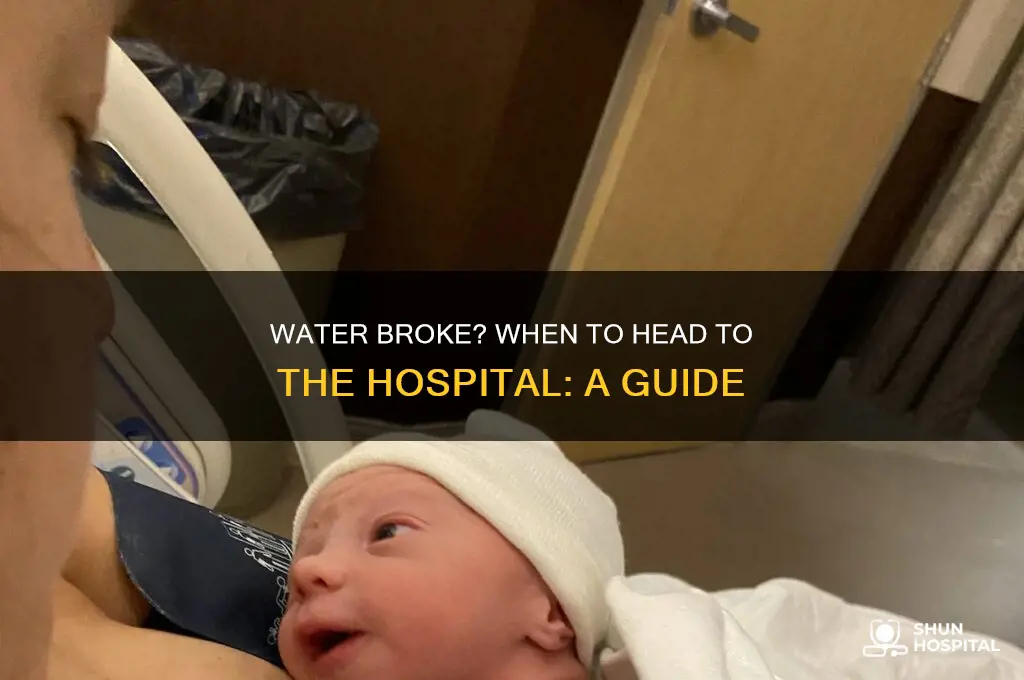 when to call hospital after water breaks