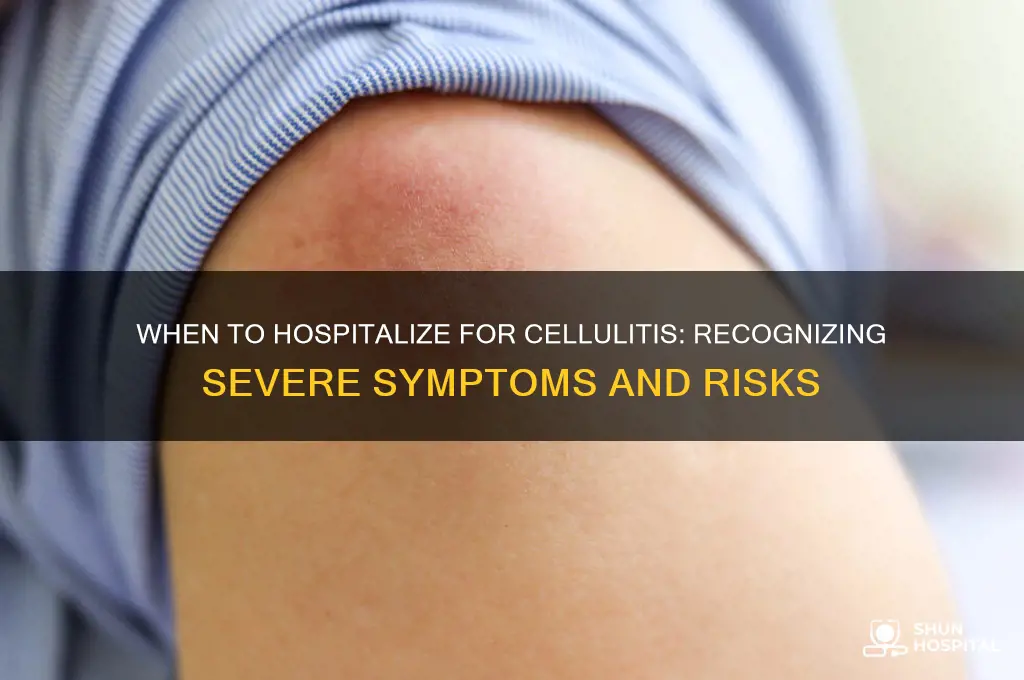 when to hospitalize for cellulitis