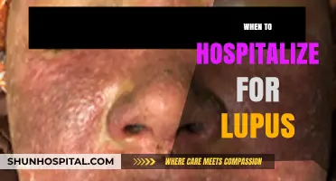 Recognizing Critical Lupus Symptoms: When Hospitalization Becomes Necessary