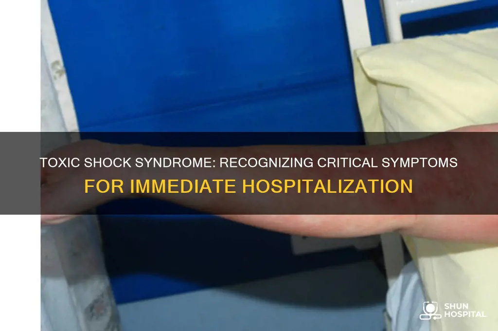 when to hospitalize for toxic shock syndrome