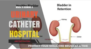 Optimal Timing for Urinary Catheter Removal in Hospital Settings