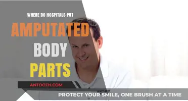 What Happens to Amputated Limbs? Hospital Protocols Explained