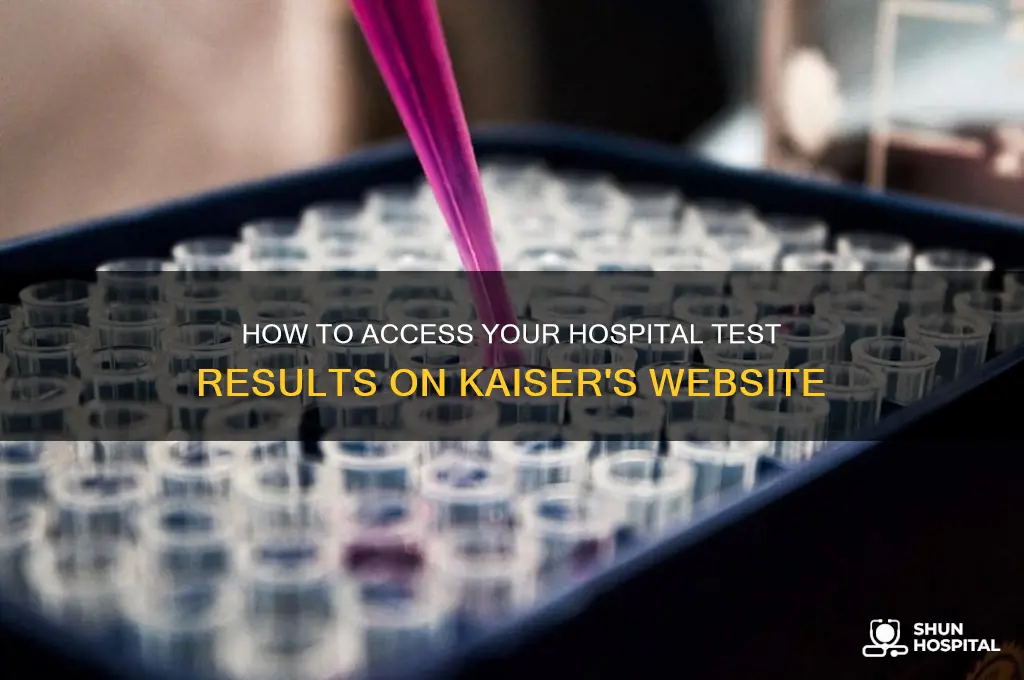 where do i find hospital test results on kaiser website