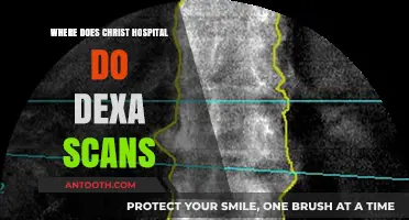 Christ Hospital DEXA Scan Locations: Where to Get Bone Density Tests