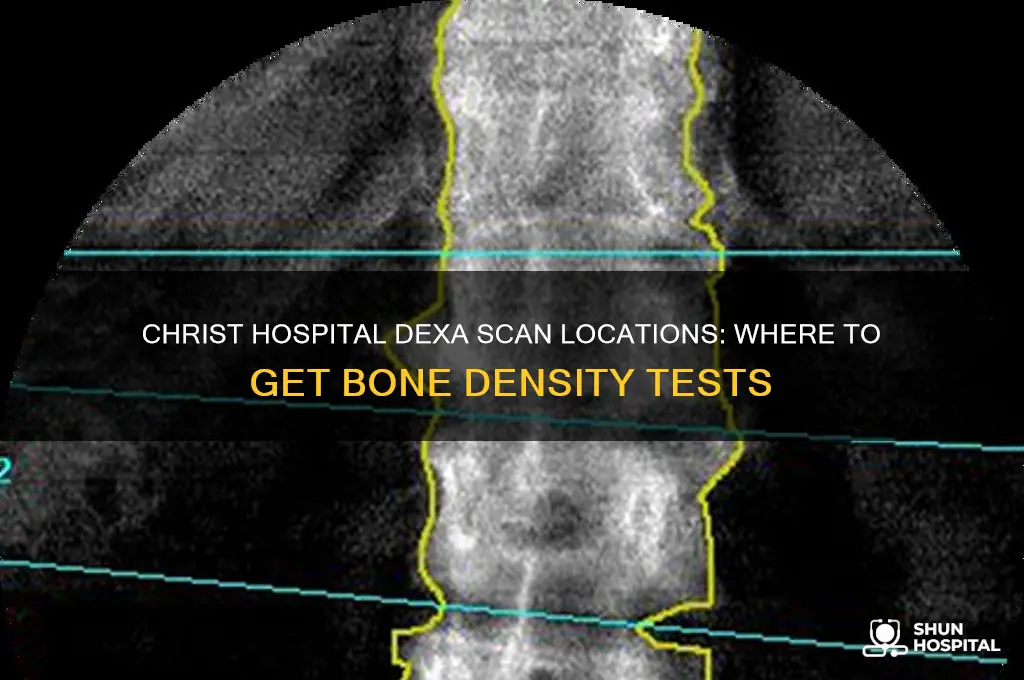 where does christ hospital do dexa scans