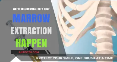 Bone Marrow Extraction: Understanding the Hospital Procedure Location