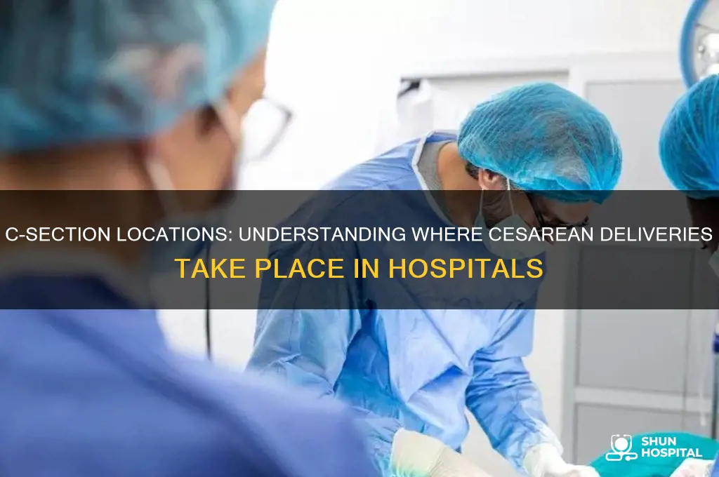 where in the hospital do they perform a c section