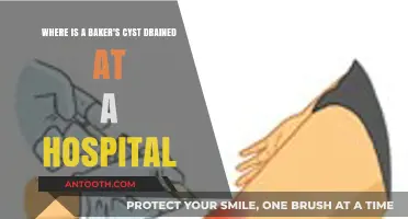 Baker's Cyst Drainage: Hospital Procedure Location and What to Expect