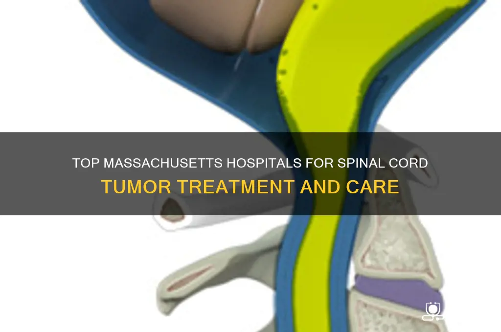where is best hospital in ma for spinal cord tumor