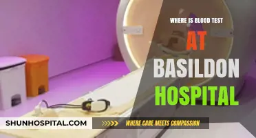 Basildon Hospital Blood Test Location: A Quick Guide for Patients