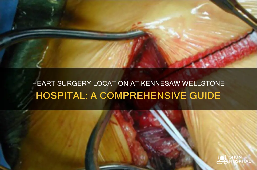where is heart surgery performed at kennesaw wellstone hospital