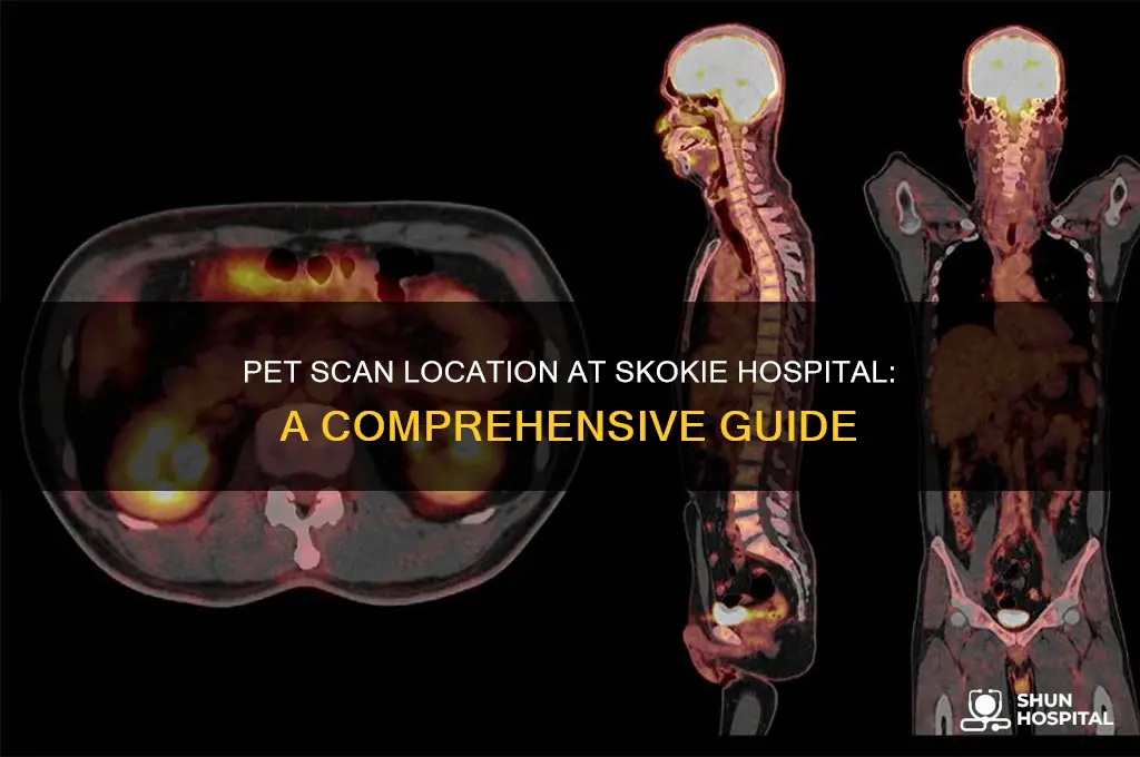 where is pet scan at skokie hospital