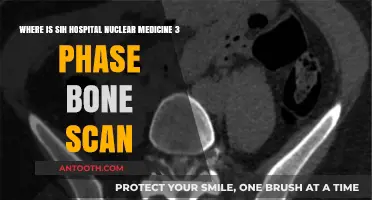 SIH Hospital's Nuclear Medicine: 3-Phase Bone Scan Location Guide