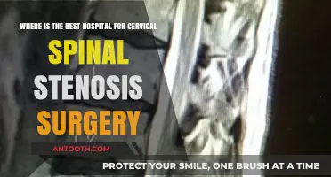 Top Hospitals for Cervical Spinal Stenosis Surgery: Expert Care Guide