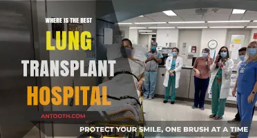 Top Lung Transplant Hospitals: Expert Care and Successful Outcomes Guide