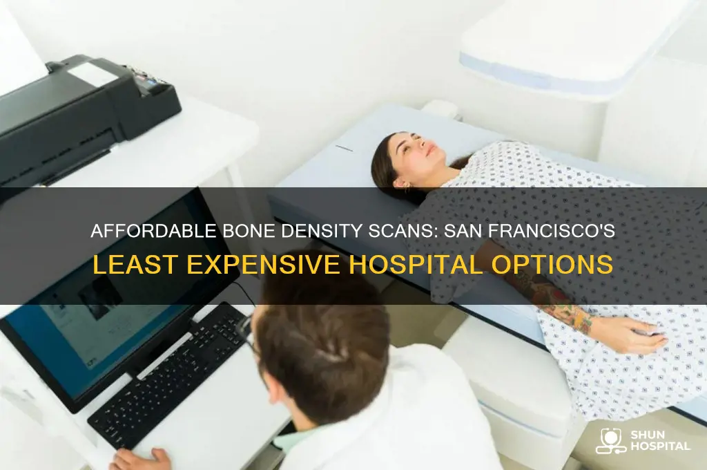 which hospital charges least for bone density in san francisco