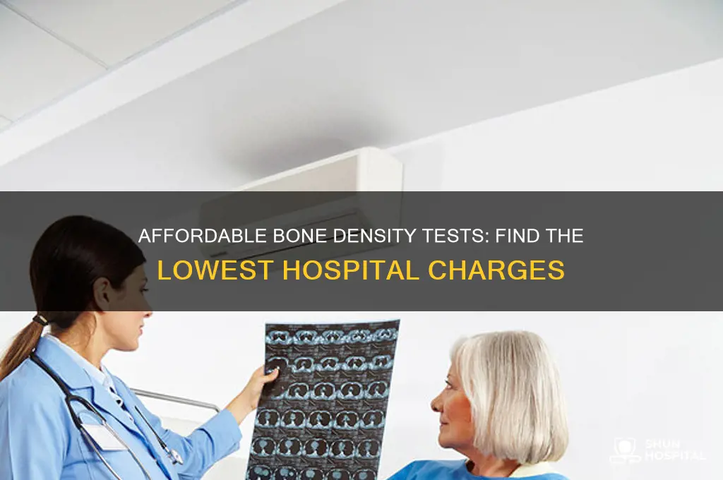 which hospital charges least for bone density