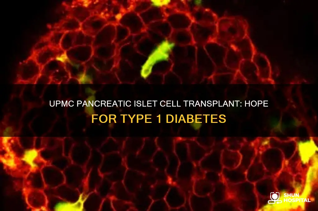 which hospital do type1 diebites pancreatic island cell transplant upmc
