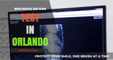 Orlando Blood Test Locations: Top Hospitals for Accurate Results