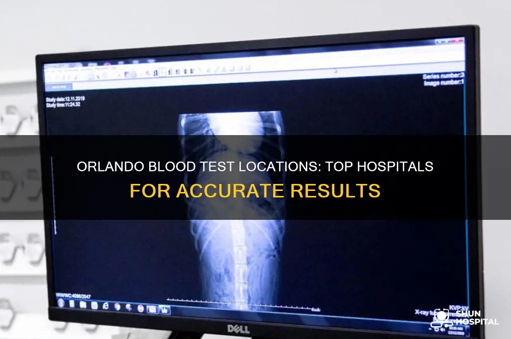 which hospital does blood test in orlando