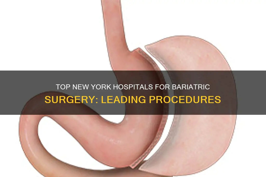which hospital does most bariatric surgery in new york