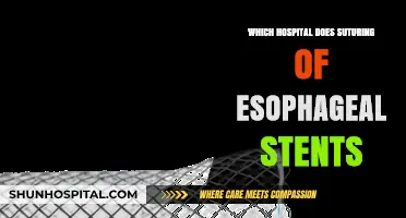 Hospitals Performing Suturing of Esophageal Stents: Expert Care Guide