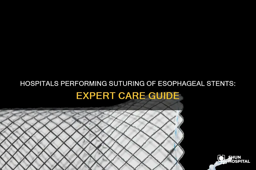 which hospital does suturing of esophageal stents