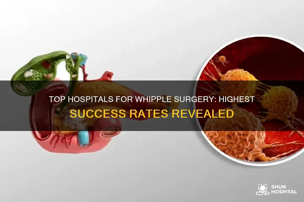 which hospital has highest success rate with whipple surgery