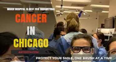 Top Chicago Hospitals for Endometrial Cancer Treatment: Expert Care Guide