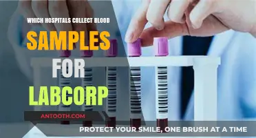 Hospitals Partnering with LabCorp for Blood Sample Collection Services