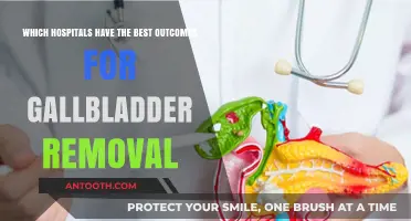 Top Hospitals for Gallbladder Removal: Best Outcomes and Care
