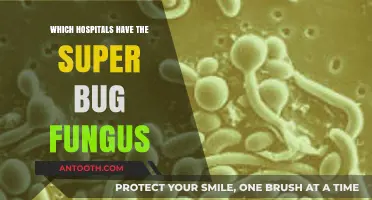 Superbug Fungus Outbreaks: Which Hospitals Are Affected and Why?