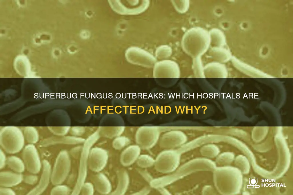 which hospitals have the super bug fungus