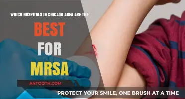 Top Chicago Hospitals for MRSA Treatment: Expert Care and Outcomes